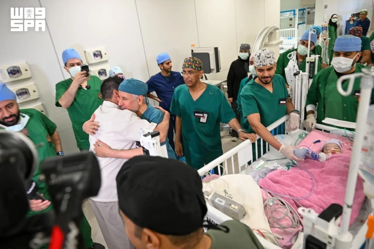 نجاح عملية فصل التوأم الملتصق المغربي سجى وضحى بعد ست ساعات