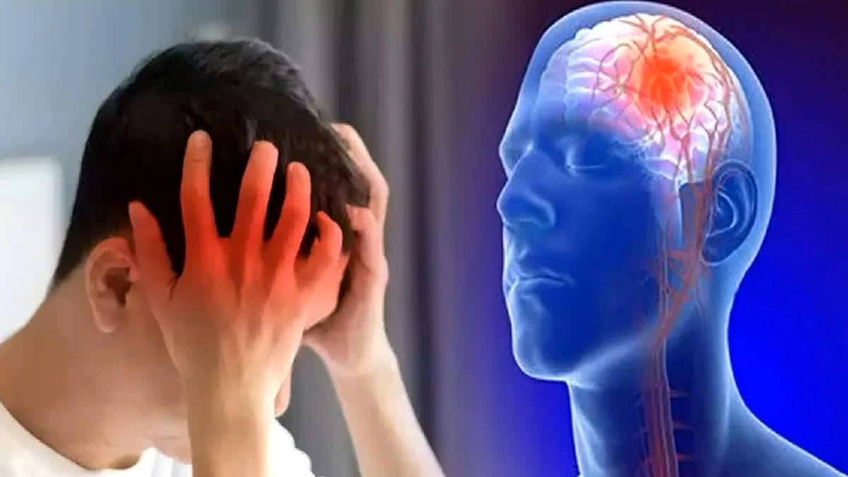 اليوم العالمي للسكتة الدماغية.. 5 دقائق قد تصنع الفارق بين الحياة والإعاقة