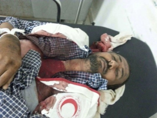 غضب يمني لاعتداء حوثيين على سيارة إسعاف وقتل مسعفين وجرحى بداخلها