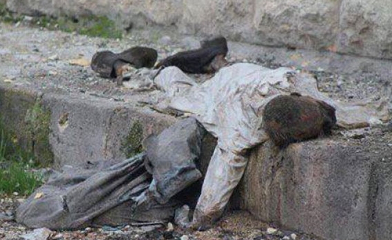 صورة مؤثرة.. وسيم زكّور “مات جوعاً” في سوريا