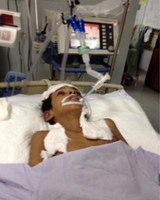 ’’فيصل‘‘ طفل التصق جلده بعظمه ولم يجد سرير‫اً‬ في مستشفى متقدم !