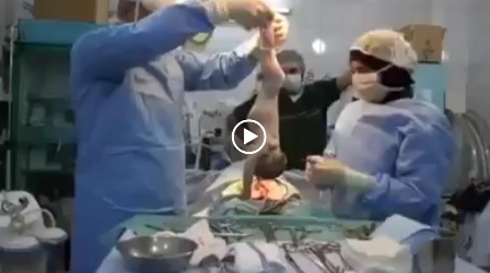 بالفيديو.. أطباء سعوديون يحاولون إنعاش مولود.. لحظات فارقة بين الحياة والموت