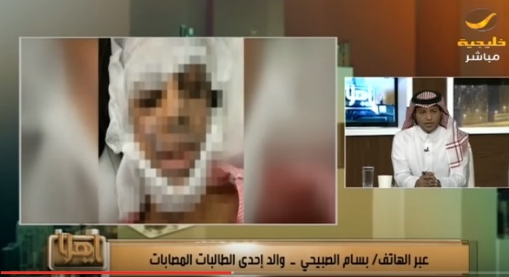 والد الطالبة المحترقة يتهم وزير التعليم بالمماطلة في علاجها