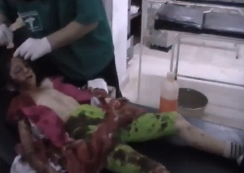 بالفيديو.. طفلة مصابة بجروح بليغة في شام درعا
