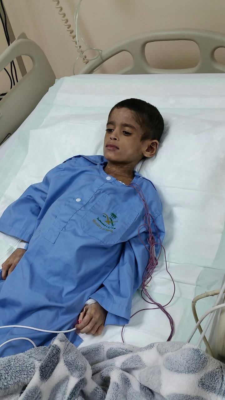 بالصور.. الطفل عبدالرحمن ترهقه 7 أمراض ووالده يناشد بعلاجه في الرياض