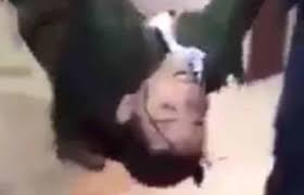 جريمة بشعة.. طفل يمني رفض ترديد صرخة الحوثي فأطلقوا النار على رأسه