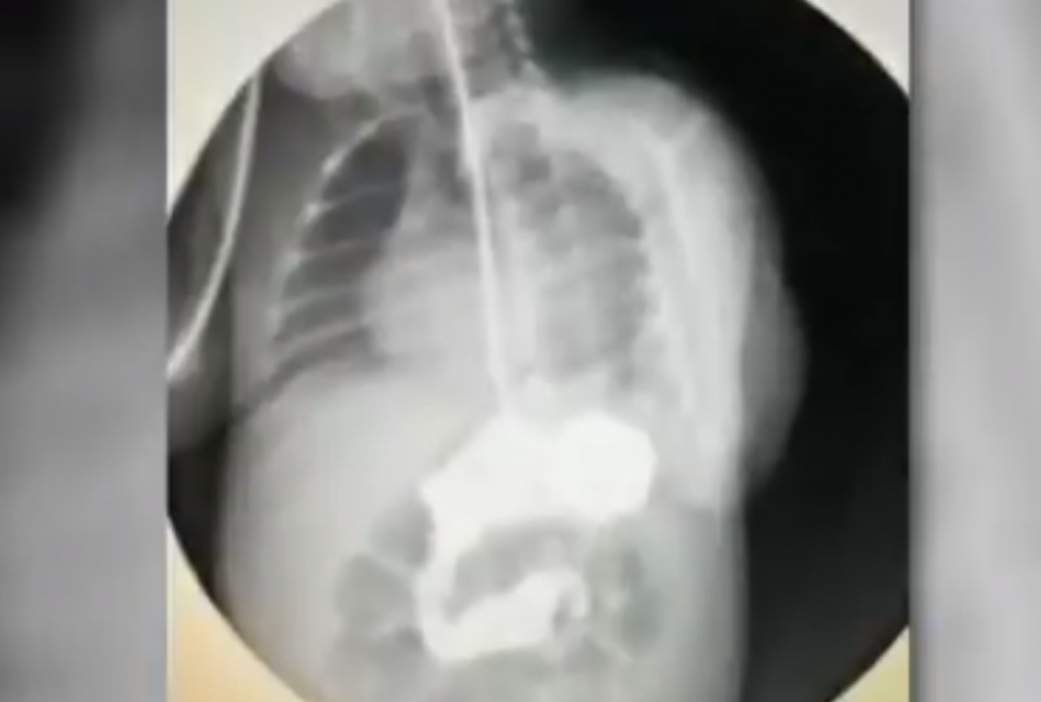 فيديو.. والد الرضيع ضحية أشعة الصبغة يكشف سبب بقائه 60 يوماً بثلاجة الموتى