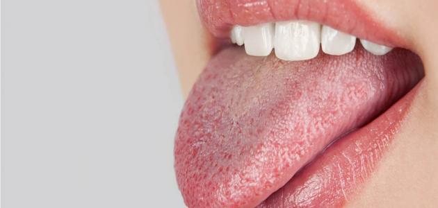 5 أسباب لجفاف الفم واللسان