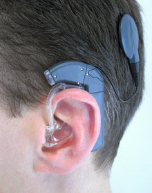 7 حالات يحتاج فيها المُصابون بمشاكل السمع استخدام السماعات
