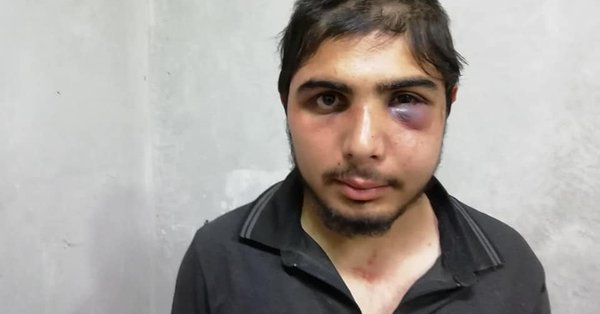 ضابط تركي يعتدي على صحفي سوري بالسلاسل