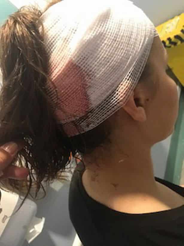 ضربت رأس صديقتها بالمطرقة بسبب سناب شات !
