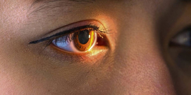 صحيفة المواطن الإلكترونية الملك خالد للعيون ينفي مزاعم علاج