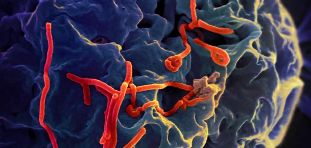 حالة طوارئ صحية بسبب إيبولا