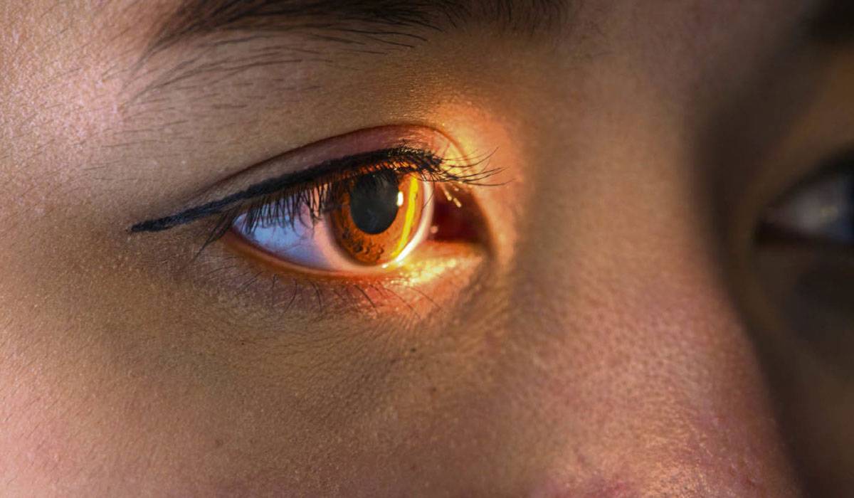 صحة الجوف عن مزاعم علاج العمى: إساءة لمهنة الطب