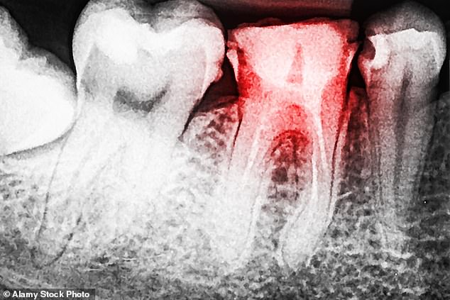 لأول مرة.. تطبيق ذكي يتيح لأطباء الأسنان تشخيص المرضى وعلاجهم عن بُعد