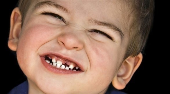 أسباب وعلاجات طحن الأسنان لدى الأطفال
