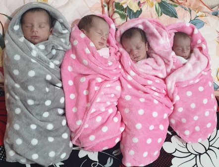 ولادة 4 توائم بمستشفى الملك عبدالعزيز بجدة