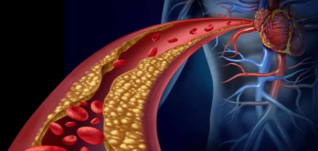 أيهما أخطر الكولسترول أم الدهون ؟ النمر يجيب