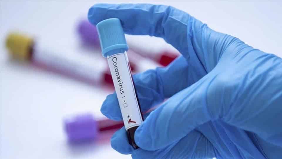 بنما تعلن تسجيل أول حالة إصابة مؤكدة بفيروس كورونا