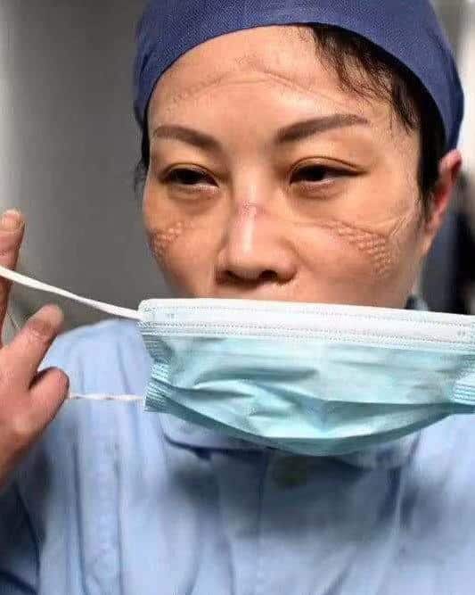 مختص لـ”المواطن”: هذه أسباب تشوه وجه الممرضة الصينية بـ الكمامة