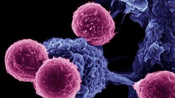 شاهد.. كيف تهاجم خلايا المناعة الخلايا السرطانية قبل تكون الورم؟