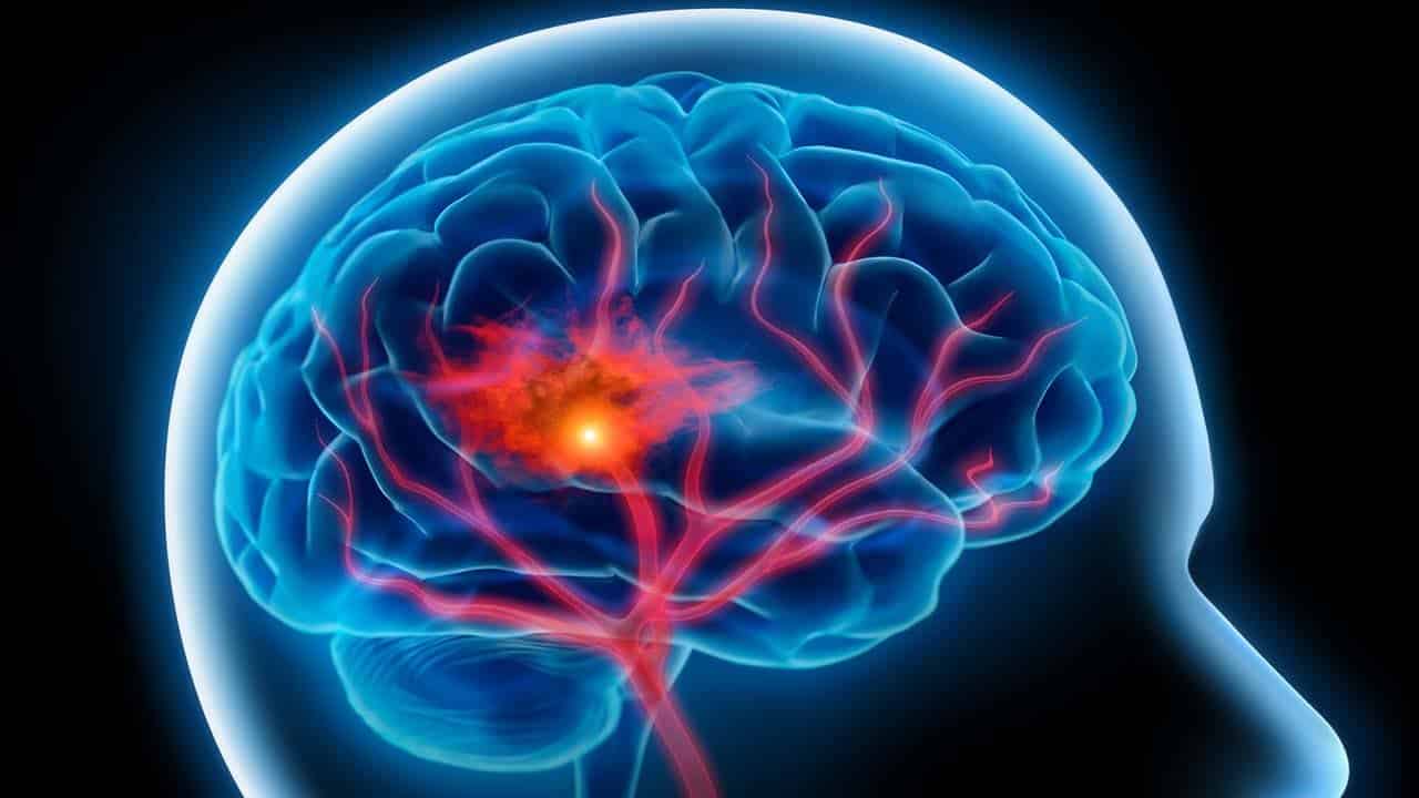 أدلة على إصابات بتلف دماغي مرتبط بكورونا