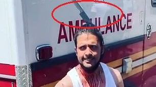 فيديو صادم.. رجل يتجول بسكين في رأسه بعد تصديه للدفاع عن امرأة 