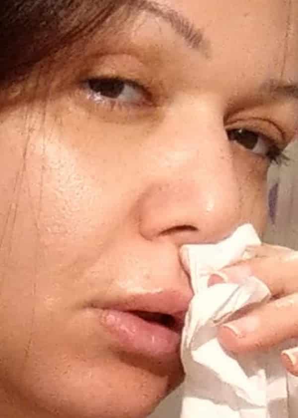 رحمة العراقية بعد تدهور حالتها بسبب كورونا : “الفيروس نزل الرئتين”