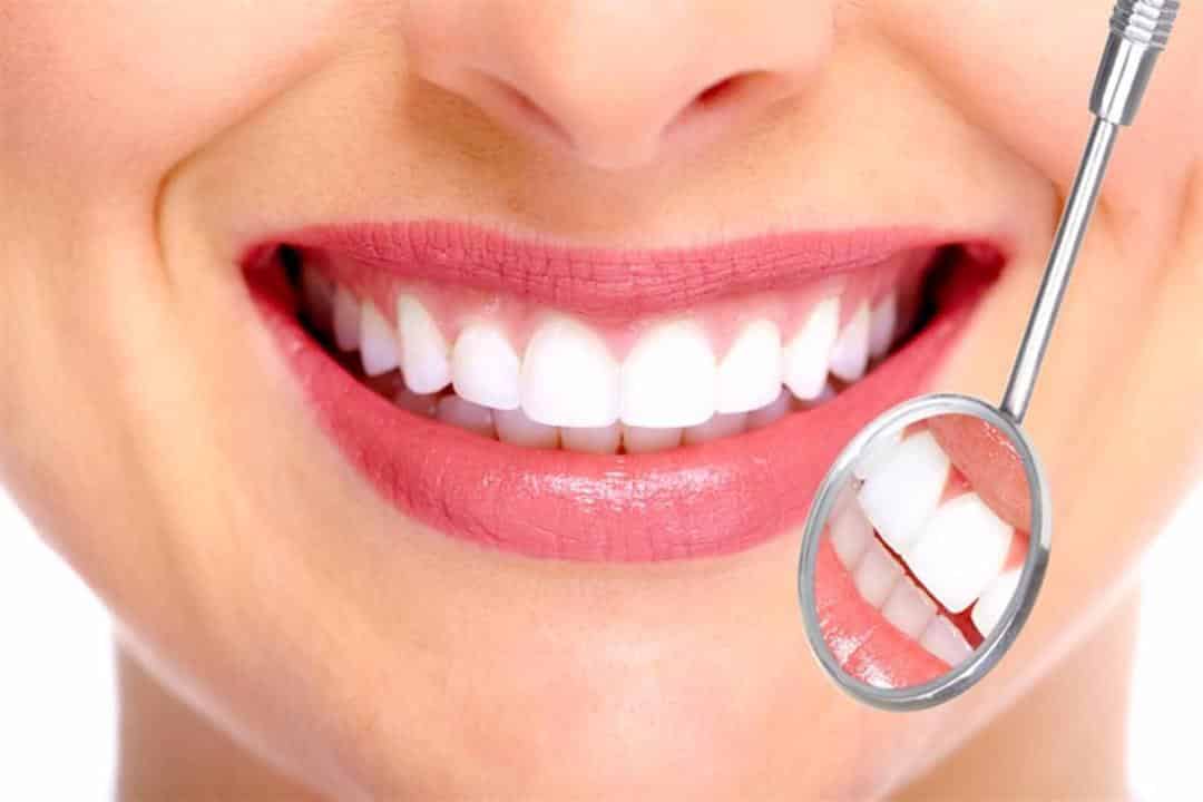 استشارية لـ”المواطن”: هذه أهم 4 مشكلات تصيب الأسنان