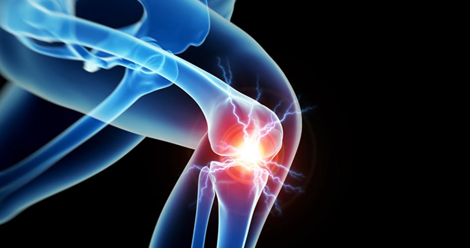 علاج مبتكر يمكن أن يخفف ألم الركبة