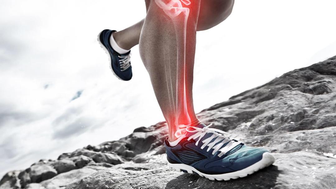 التهاب العضلات وراء آلام قصبة الساق