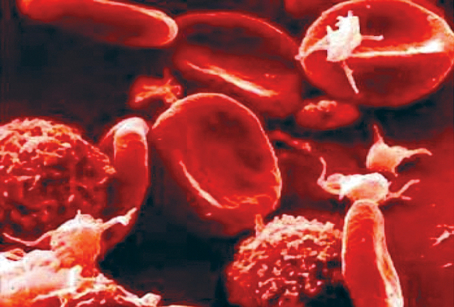 ابيضاض الدم الليمفاوي الحاد