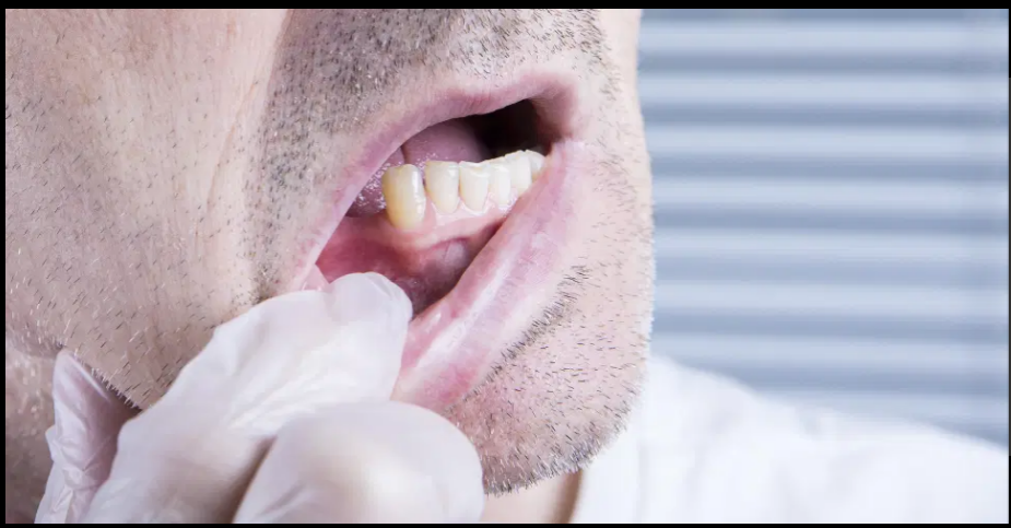 الصحة: 4 خطوات لإعادة الأسنان الدائمة بعد سقوطها
