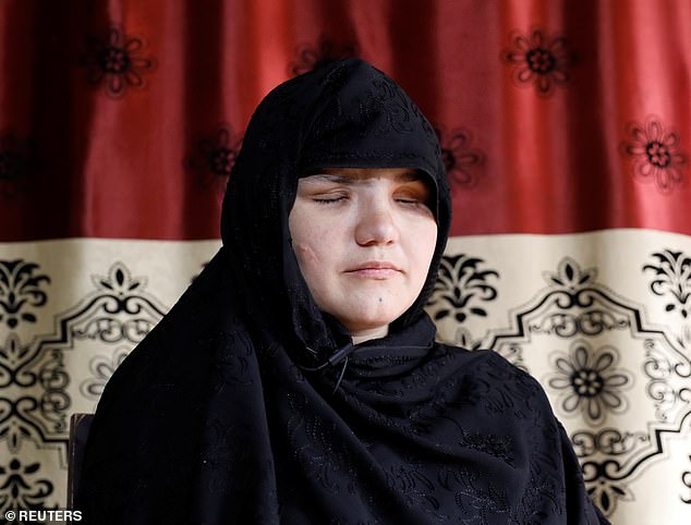 رجل يستعين بحركة طالبان لفقأ عيني ابنته بسبب خروجها للعمل