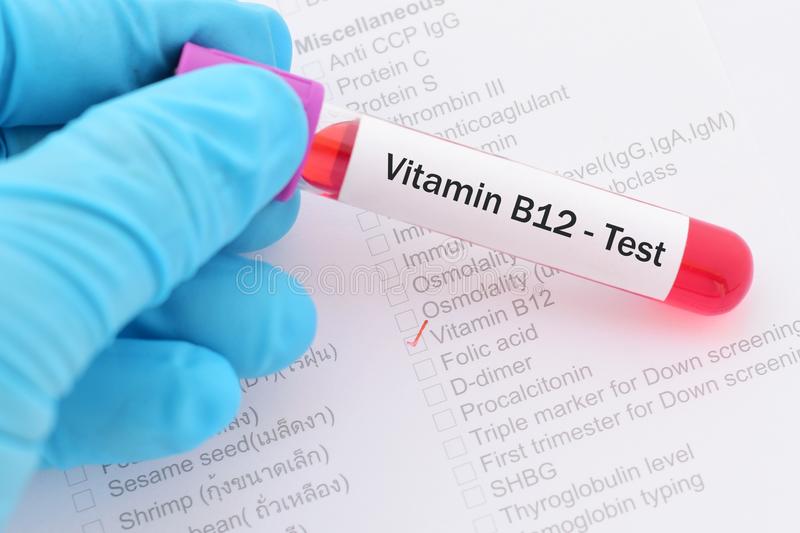 B12 نسبة الطبيعية فيتامين نسبة فيتامين