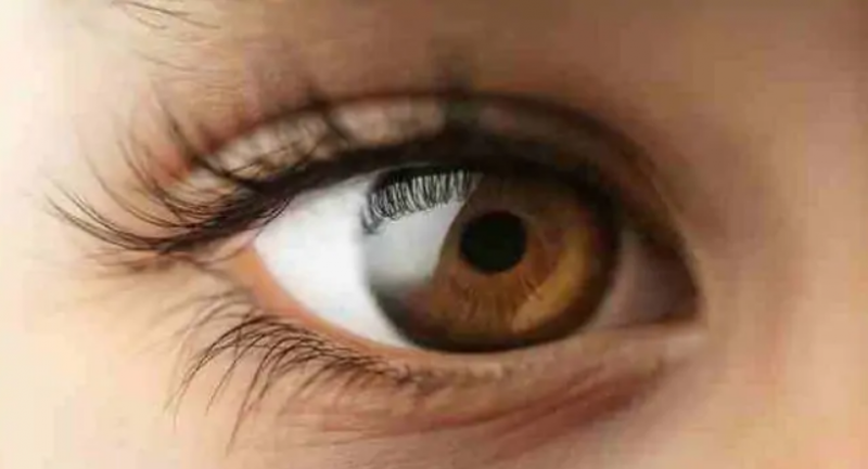كيفية التخلص من جفاف العين بشكل طبيعي