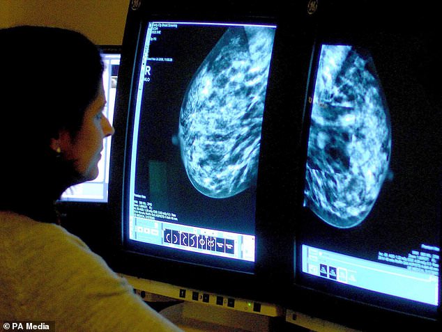 سرطان الثدي أكثر أنواع السرطانات تهديدًا في العالم