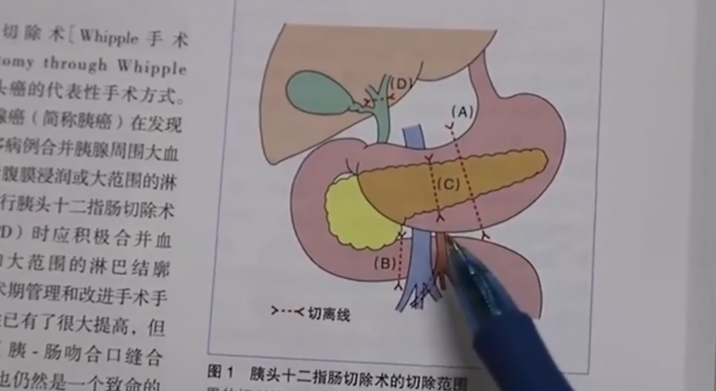 رجل جلده يتحول للأصفر بسبب التدخين !  (4)