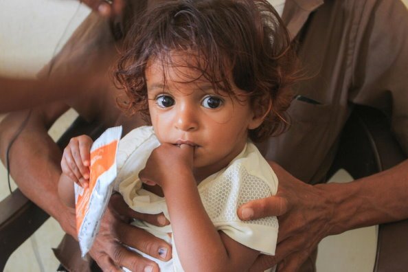 خطر المجاعة الحادة يهدد 20 دولة بينها 4 دول عربية