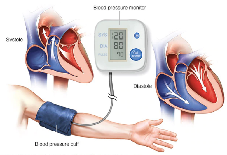4 أعراض نادرة تدل على ارتفاع ضغط الدم الخطير (1)