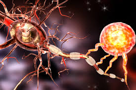 6 معلومات وحقائق عن التصلب اللويحي Multiple sclerosis