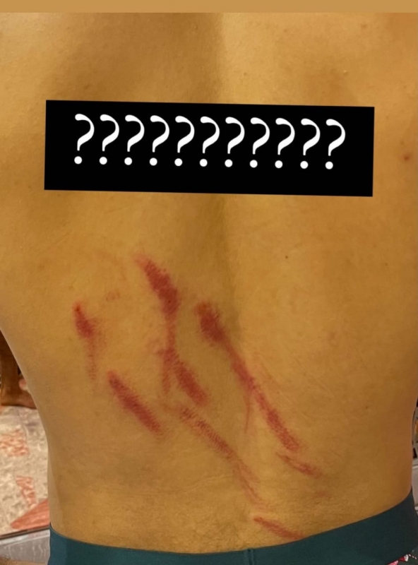 إصابة محمد شريف في ظهره