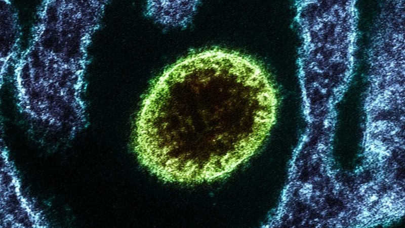 اكتشاف تفشي أحد أخطر الفيروسات في الهند