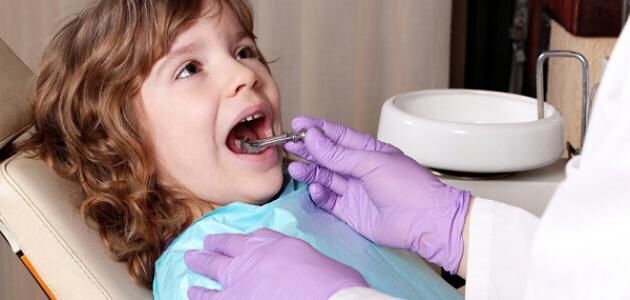 المشروبات السكرية أهم مسببات تسوس الأسنان عند الأطفال