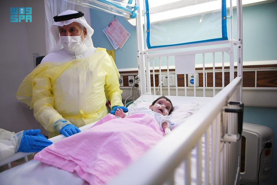 الطفلة اليمنية عائشة تغادر العناية المركزة بعد 12 يومًا من عملية الفصل
