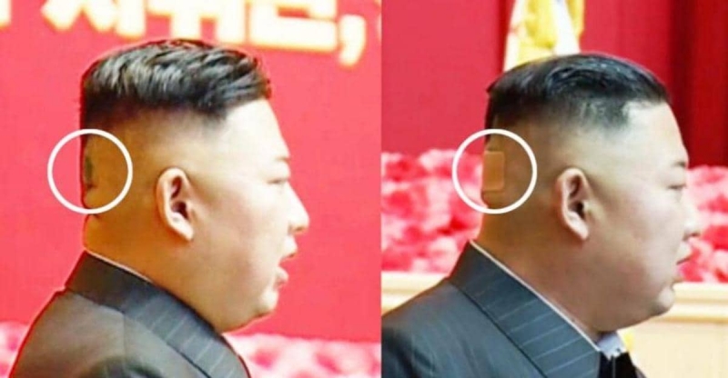 بقعة غريبة على رأس زعيم كوريا الشمالية تثير التساؤلات