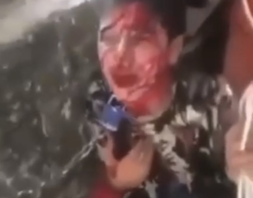“اقتلني بابا” صرخة طفل عراقي يطلب الموت هربًا من تعذيب والده