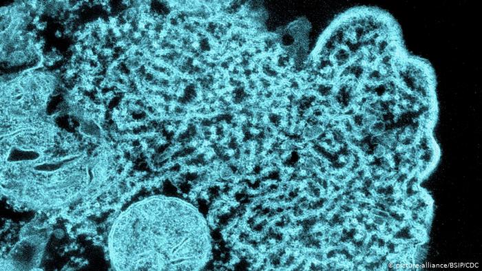 فيروس نيباه يتسبب بإعلان حالة التأهب القصوى في الهند