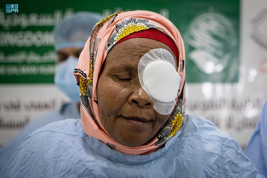 مركز الملك سلمان للإغاثة يجري 785 عملية لمكافحة العمى في جيبوتي
