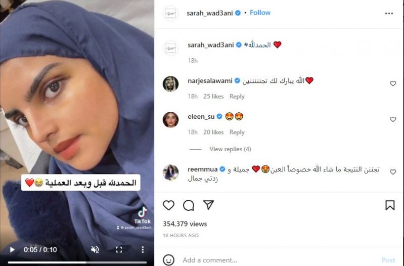سارة الودعاني تتعافى من 3 جراحات تجميلية - المواطن